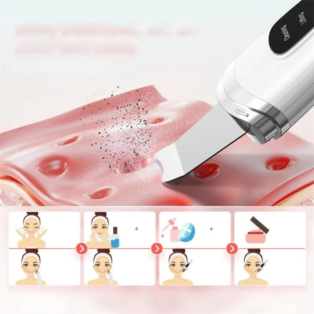 SkinPurifer® Ultrasonique